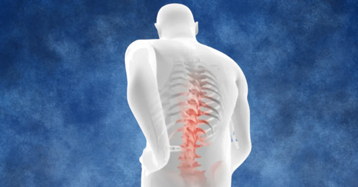 The Patient's Guide to Spinal Stenosis - CMD - New Jersey