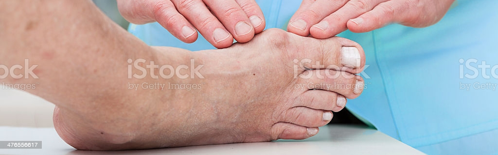 Bunion Surgery The Center For Musculoskeletal Disorders